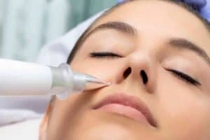 Best Actinic Keratoses Removal 3 Actinic keratoses Melksham solutions - book in today!